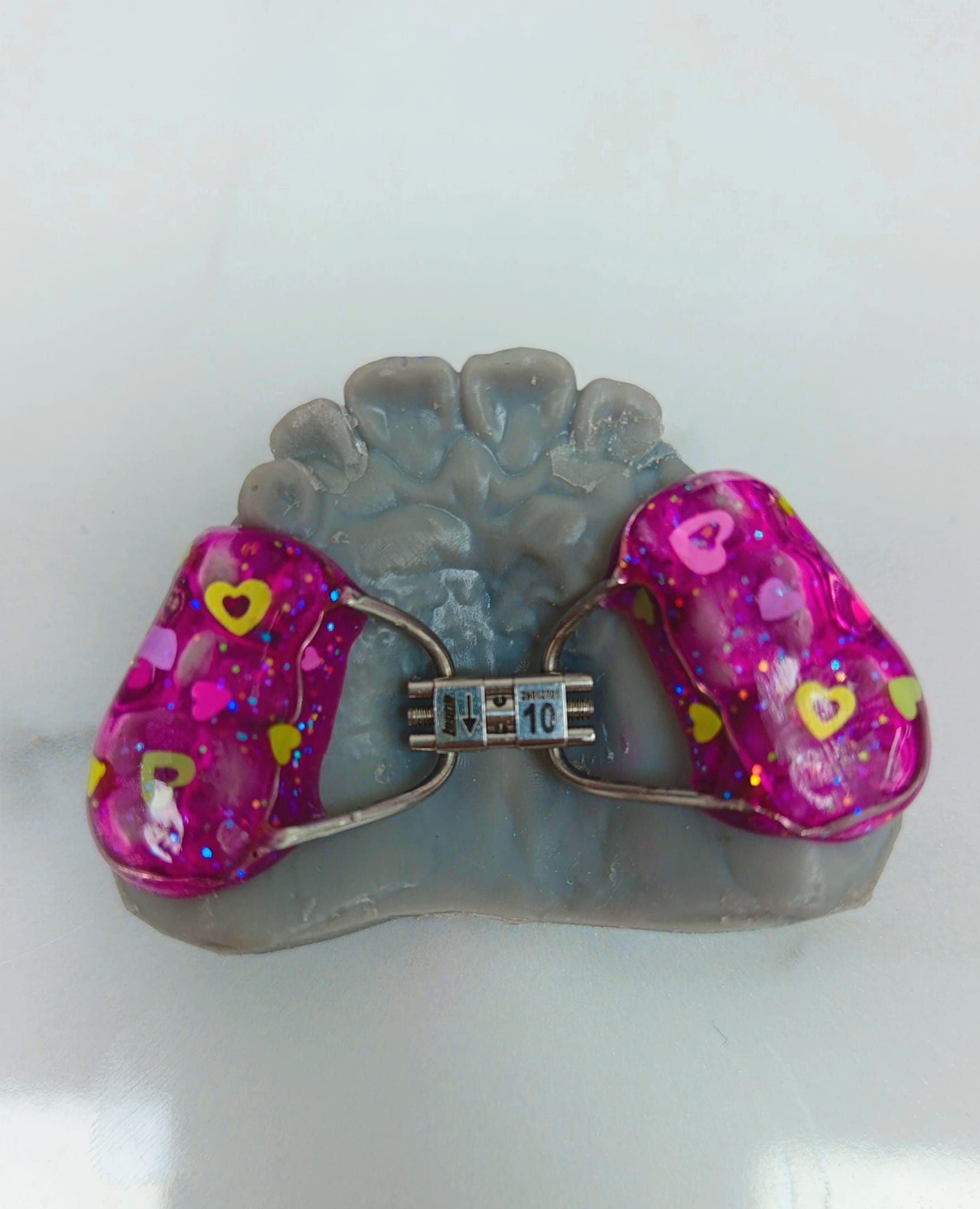 Mantenedor de espacio lateral sobre modelo dental - Laboratorio Sandoval
